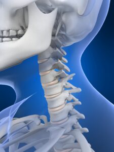 découvrez les meilleurs remèdes pour soulager les douleurs cervicales : solutions naturelles, exercices, conseils de prévention et traitements efficaces pour améliorer votre bien-être au quotidien.